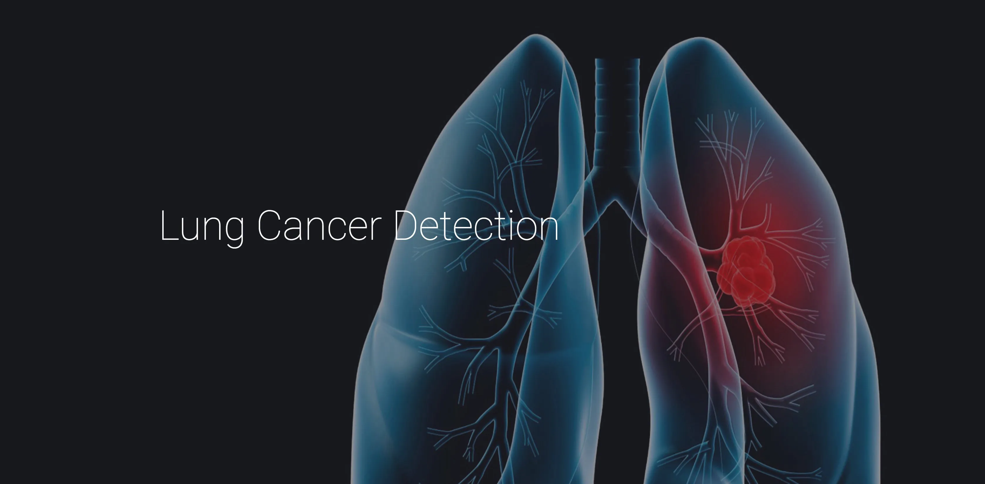 Lung Cancer Detection